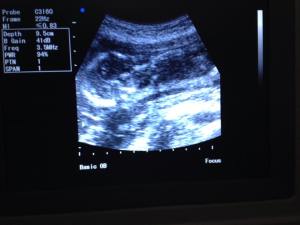 It's blurry, but you get the idea: it's a baby!